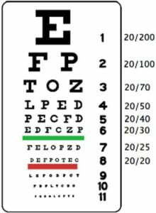 Lunettes dioptries